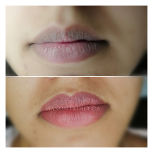 Maquillage permanent lèvresDermopigmentation